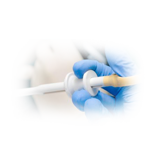 
								<h1>
									<span>
										MUCOSECTOMIAS
									</span>
								</h1>
								<p>
                                A mucosectomia é uma técnica amplamente utilizada, que consiste na injeção de líquido nas camadas profundas da parede do órgão antes da ressecção da lesão, permitindo a remoção da mucosa acometida com menor risco de perfurações. 
								</p>    
								<a href="https://www.clinicazago.com.br/procedimentos-terapeuticos/mucosectomias/">Saiba mais</a> 
							